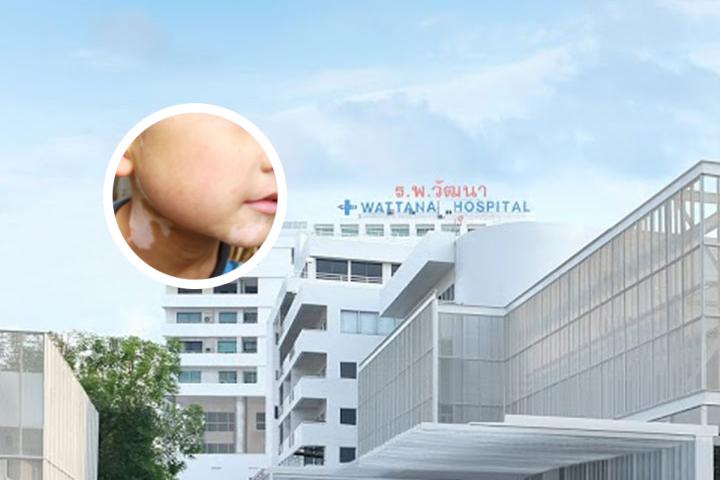 潍坊有没有治疗白斑的医院(潍坊治疗白斑的医院)